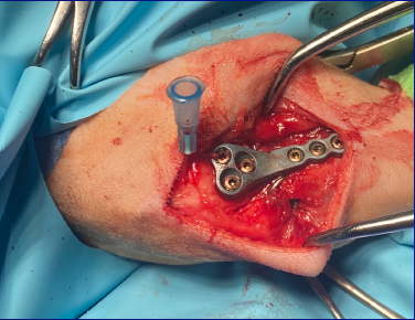 Cranial Closing Wedge Osteotomy